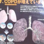 煙草やめますか？人間やめますか？